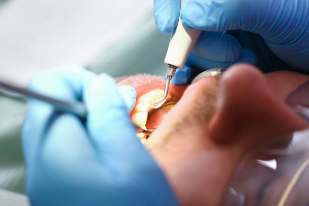 Best After-Hours Dental Trauma Care in Falmouth Foreside, ME