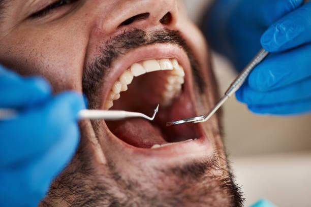 Best Cosmetic Emergency Dentistry in Falmouth Foreside, ME